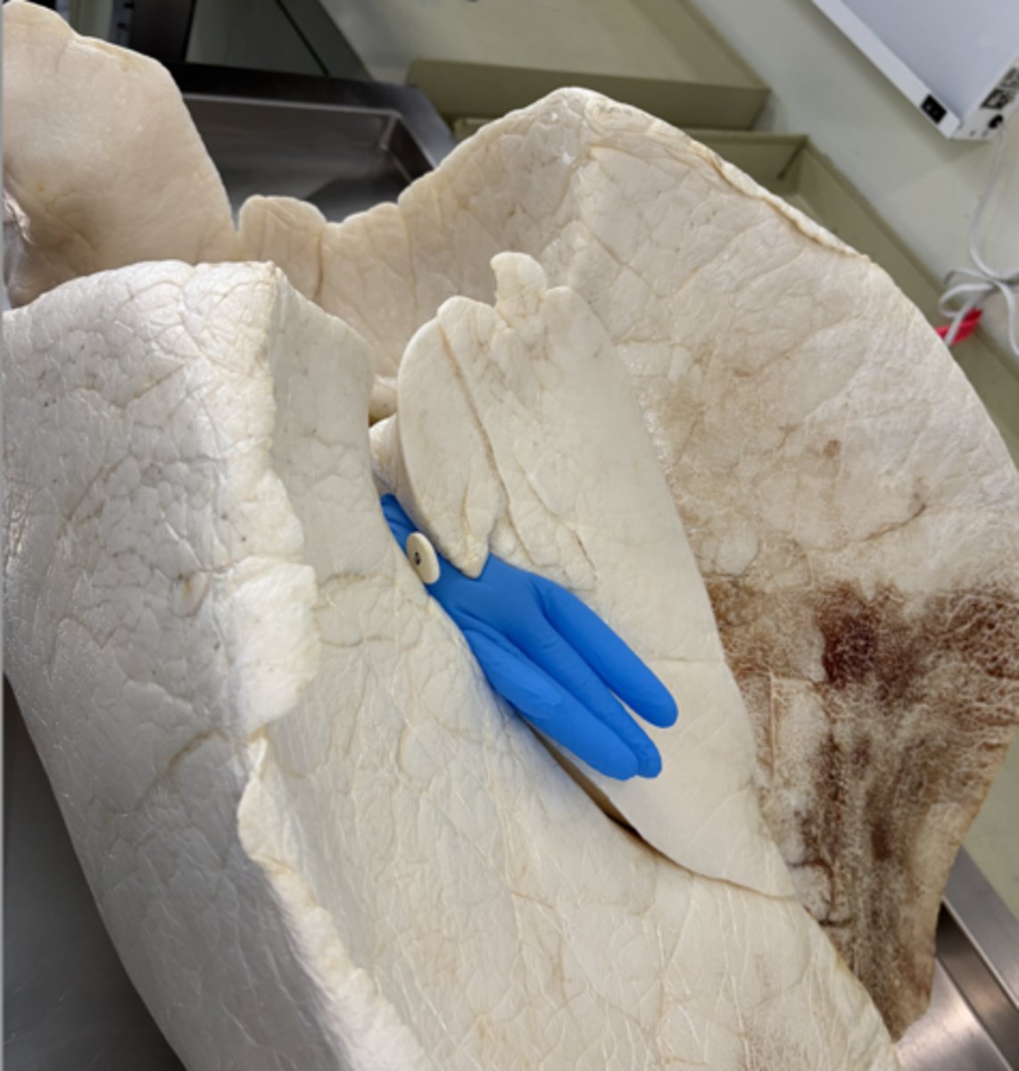 <p>a. ID the groove the blue glove is in</p><p>b. Name one nerve structure that passes in this space</p>