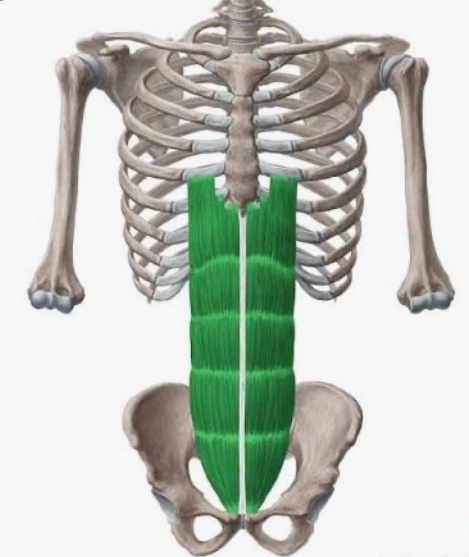 <p>rectus abdominis</p>