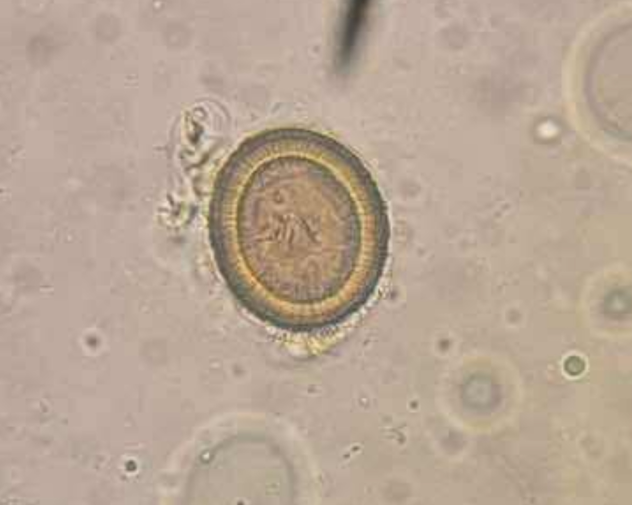 <p>A. identify the organism</p><p>B. what group does this organism belong to</p>