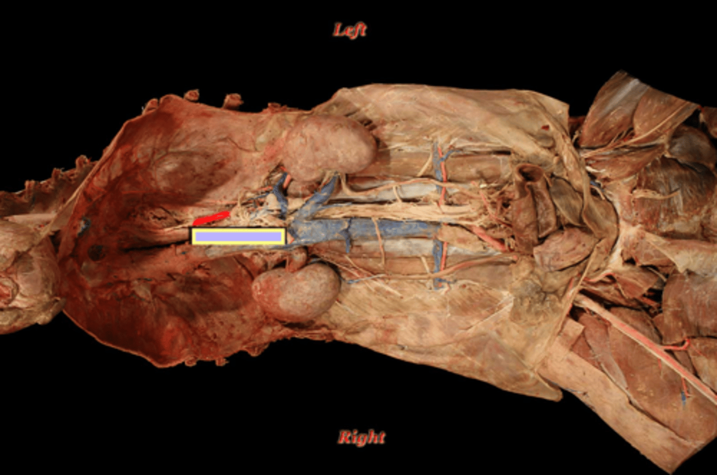 <p>Blood supply of the esophagus:</p><p>- abdominal esophagus (near stomach)</p>