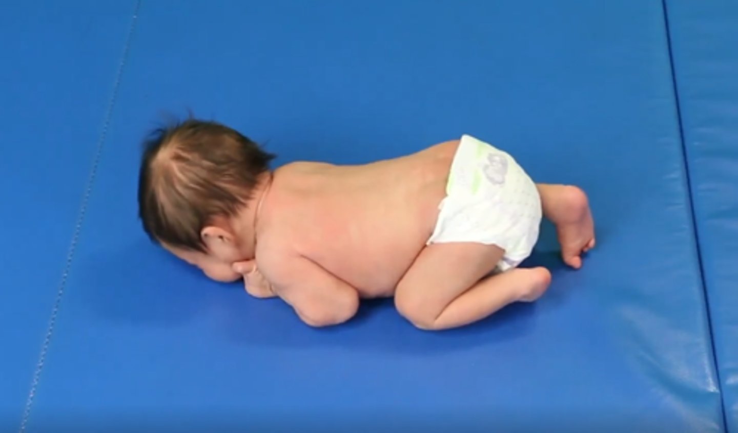 <p>1. Legs Flexed UNDER Pelvis (froggy)</p><p>2. Pelvis doesn't touch supporting surfaces</p><p>3. Infant cannot lift head into extension</p>