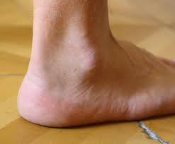 <p>Ankle </p>
