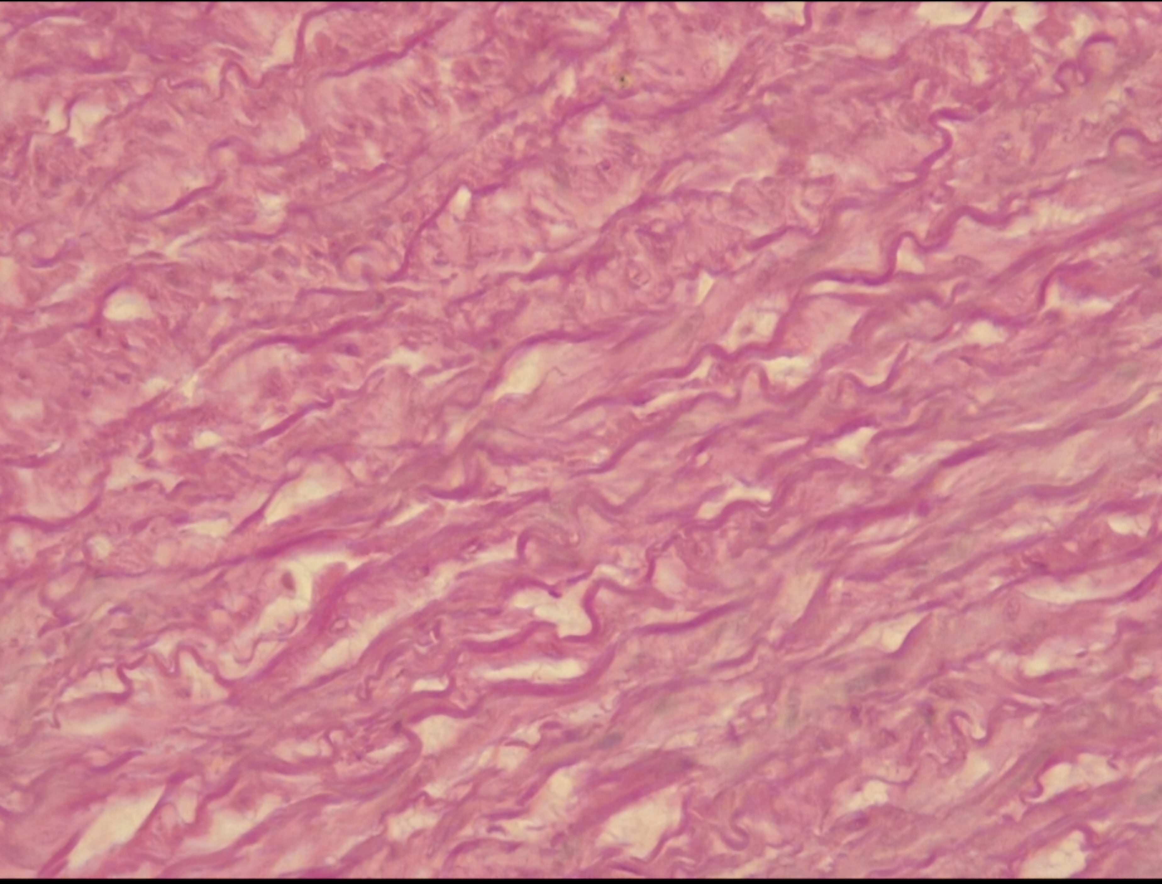 <p>Dense elastic </p>