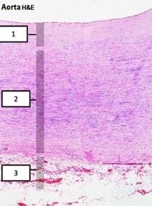 <p>what blood vessel layers?</p>