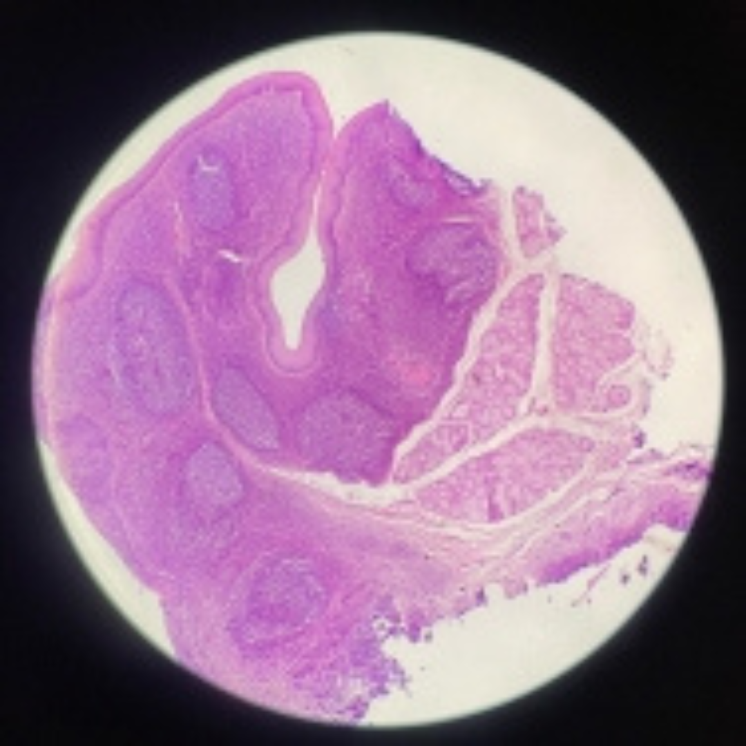 term image