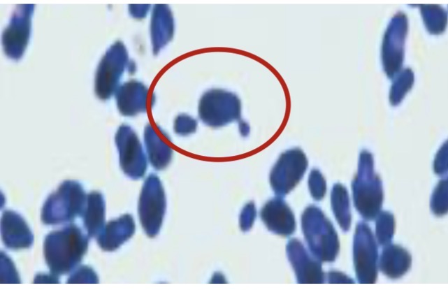 <p>Identify the fungi</p>