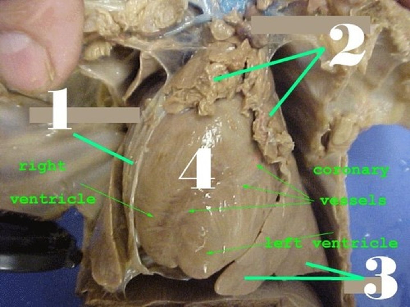 <p>-a gland located near the heart</p><p>-secretes thymosins to help T lymphocytes (infection fighting white blood cells) mature</p><p>-when hit puberty, shrinks due to sex hormones</p>