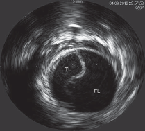 <p>What is happening in the image below</p>