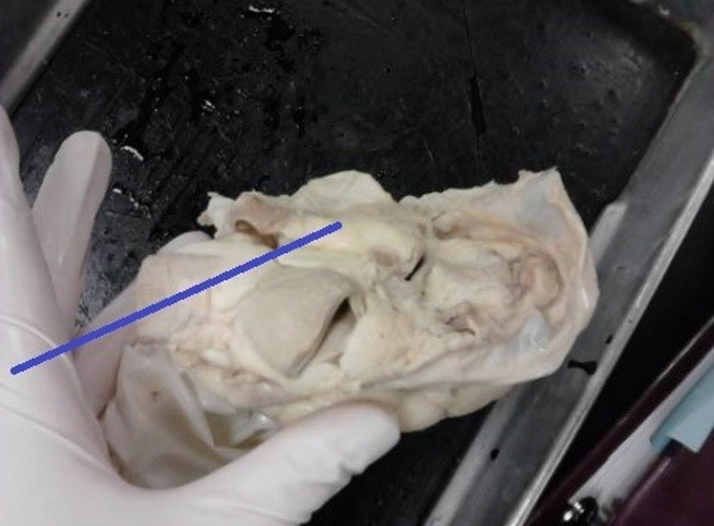 <p>Identify the blood vessel that carries blood from the right ventricle to the lungs</p>