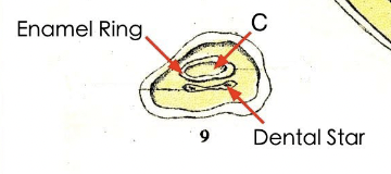 <p>Outline of enamel layer over the infundibulum</p>