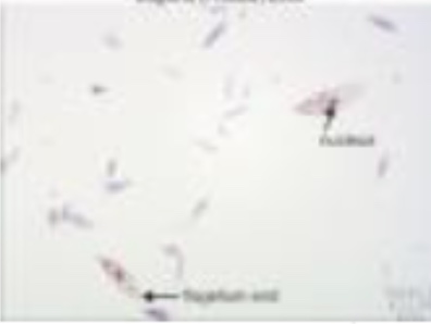 <p>What is this (classification of protozoa based on locomotion structure)</p>
