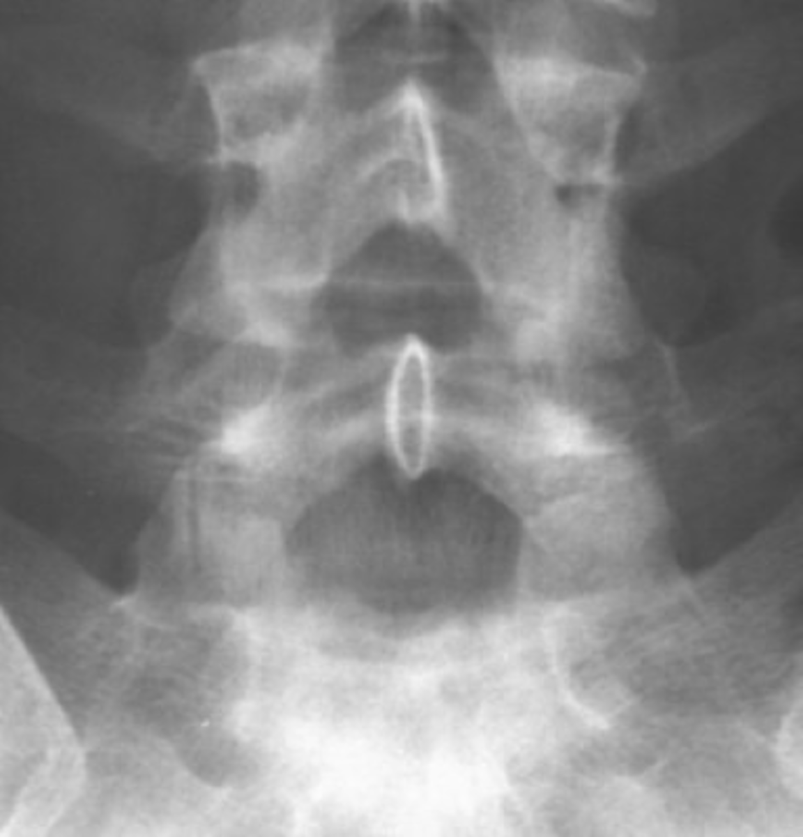 <p>Can you adjust this patient?</p>