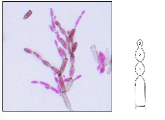 <p>Acropetal chaining with branches</p>