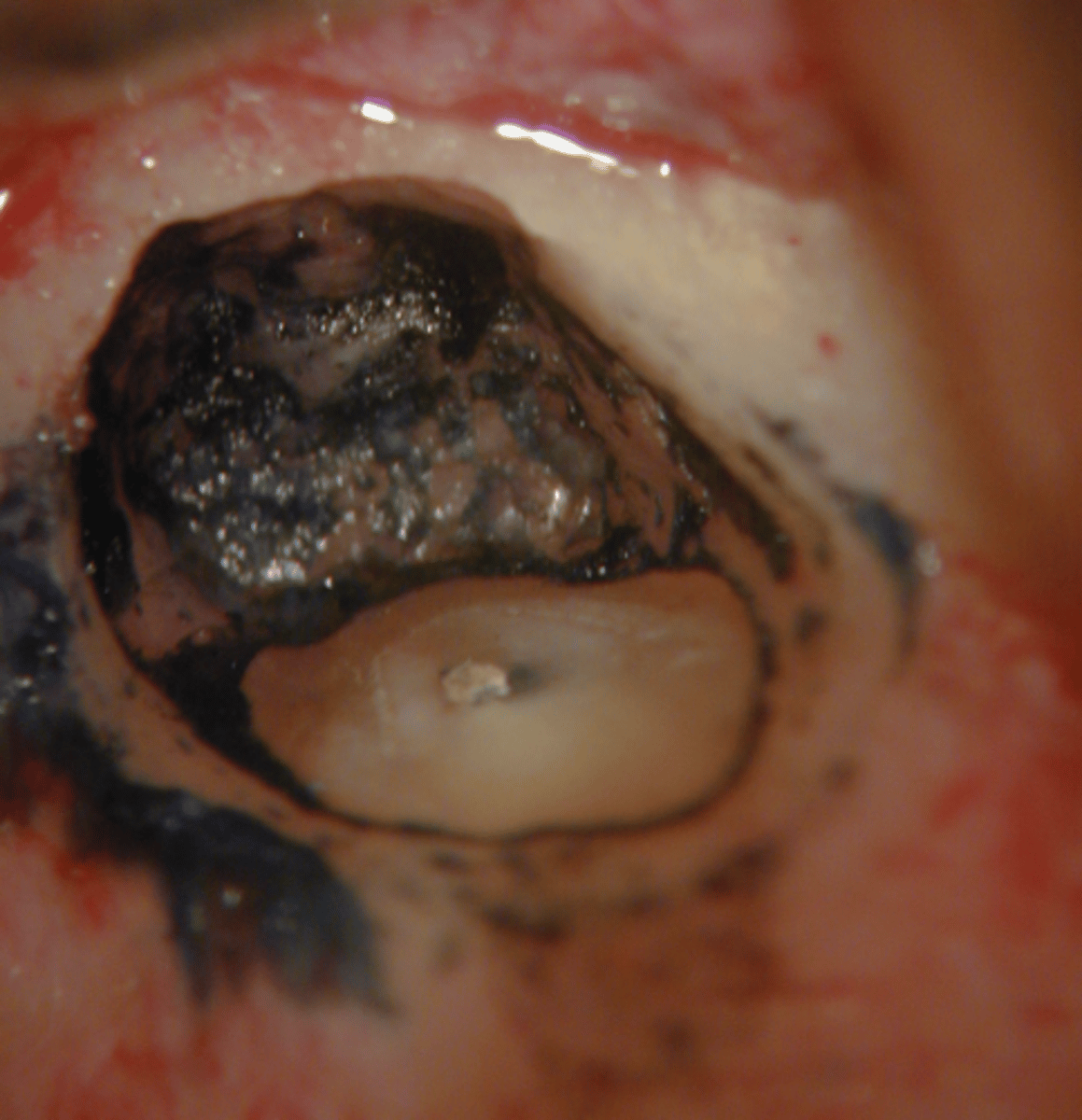 <p>Why is the dye used here?</p>