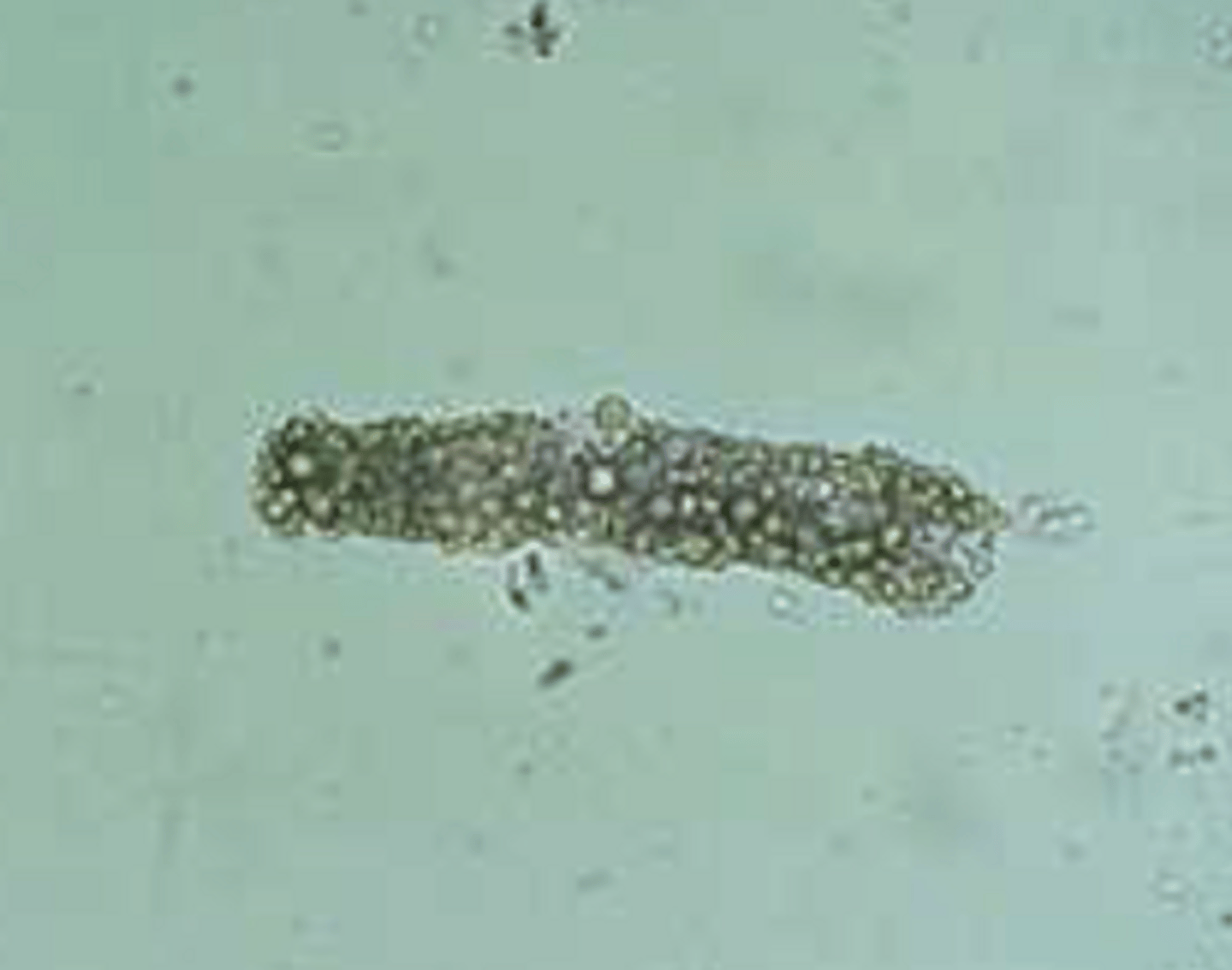 <p>- Seen more frequently in cats with renal disease or dogs with diabetes</p><p>- Have small fat droplets</p>