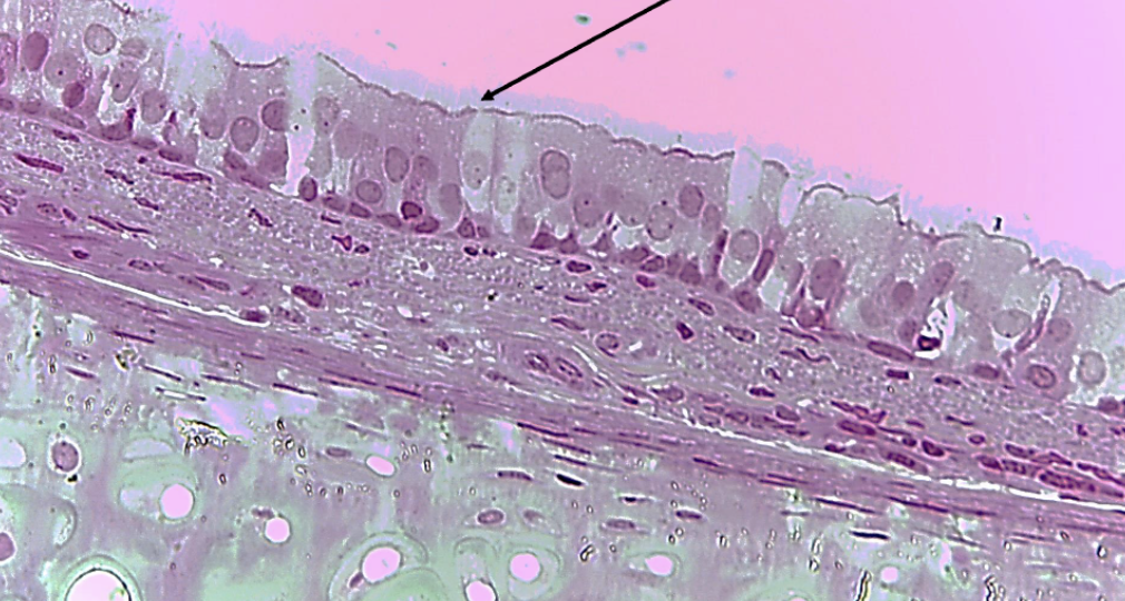 <ol><li><p><strong>Name this tissue type</strong></p></li><li><p><strong>Explain it’s function.</strong></p></li><li><p><strong>Name a location<br>where you can find this tissue in<br>the body.</strong></p></li></ol><p></p>