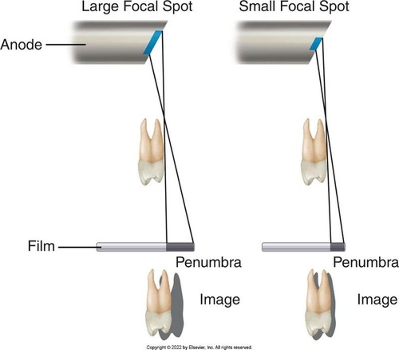 <p>Focal spot size, film composition, movement.</p>