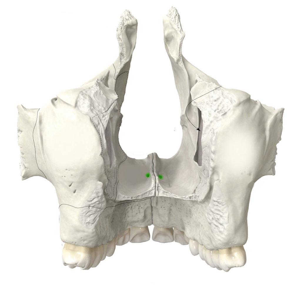 <p>orrüreget a szájüreggel összekötő csatorna</p>