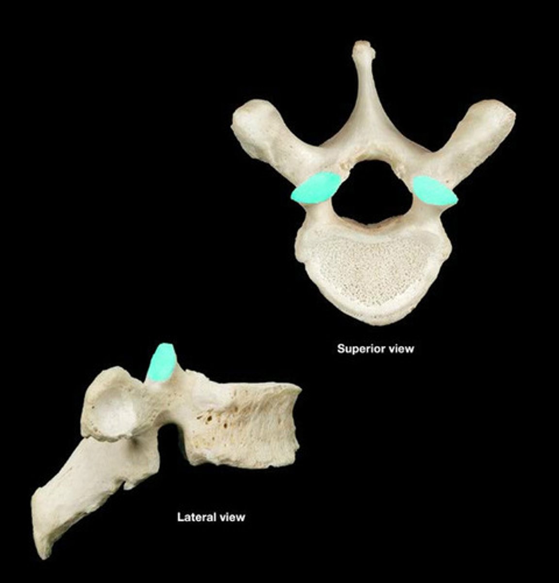 <p>articulate with the inferior articular facets of superior vertebrae</p>