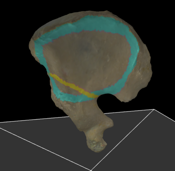 <p>Een lijn die begint bij de spina iliaca anterior superior en die ongeveer evenwijdig loopt aan de rand van het acetabulum.</p>