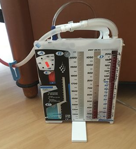 <p><span><span>Removal of a chest tube may result in pneumothorax. A radiograph of the chest is needed to rule out pneumothorax prior to mobilization of the patient</span></span></p>