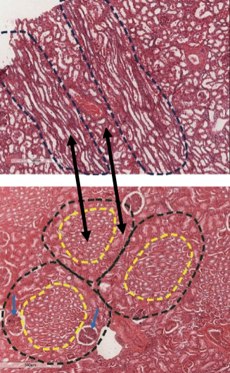 <p>what is this (in between outlines)</p>