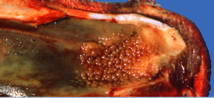 <p>Granulomatous</p>