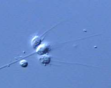 <p>They are <strong>tiny, stalked organisms</strong> that attach to surfaces.</p>