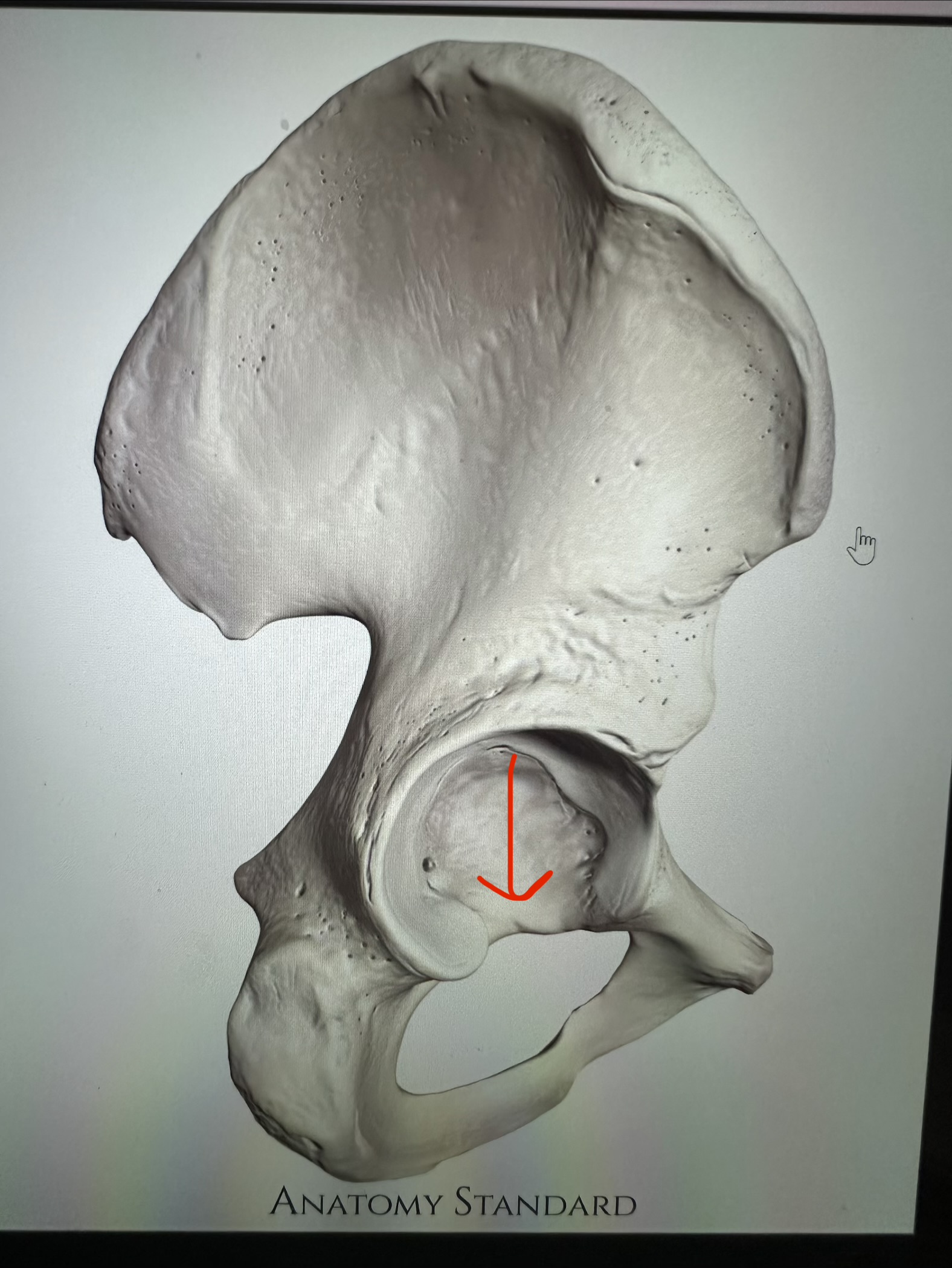 <p>os coxae, edge of acetabulum that meets foramen obturatum</p>