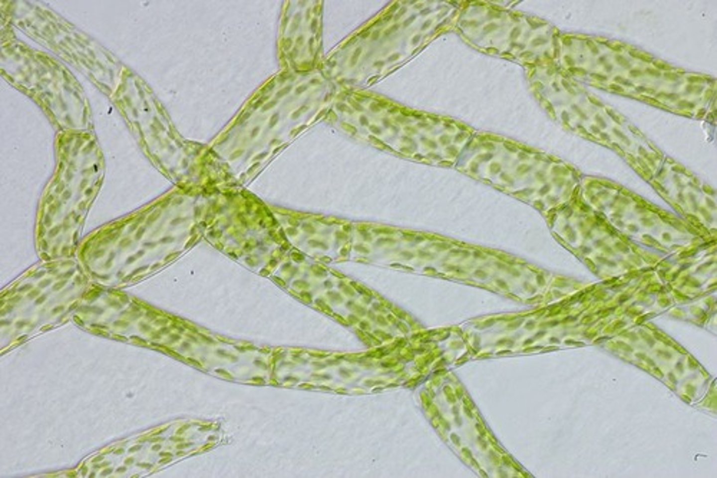 <p>The name for the young gametophyte of a moss.</p>