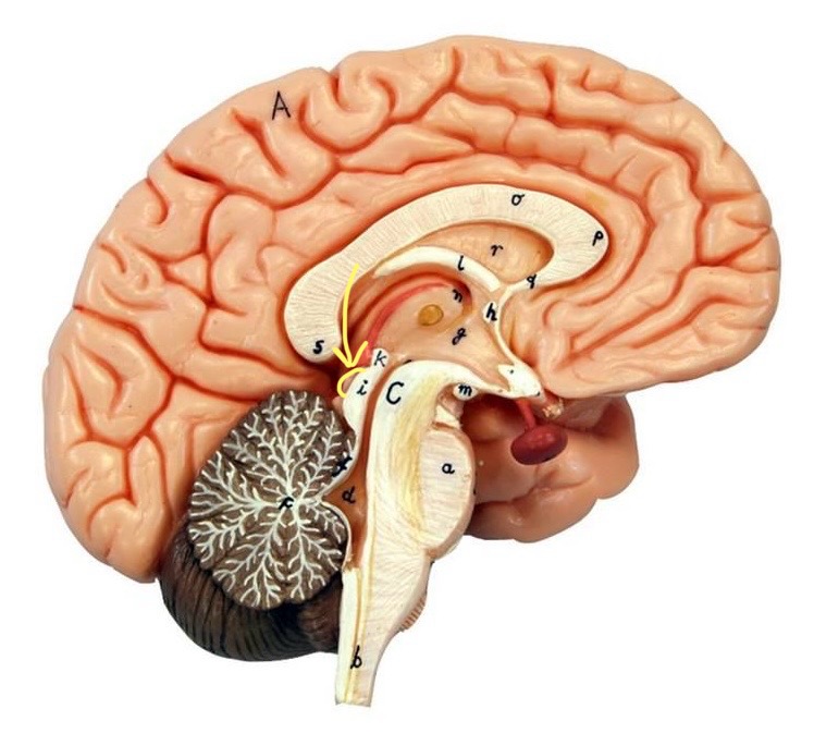 term image