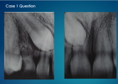 <p>not sure about this one ask professor</p>