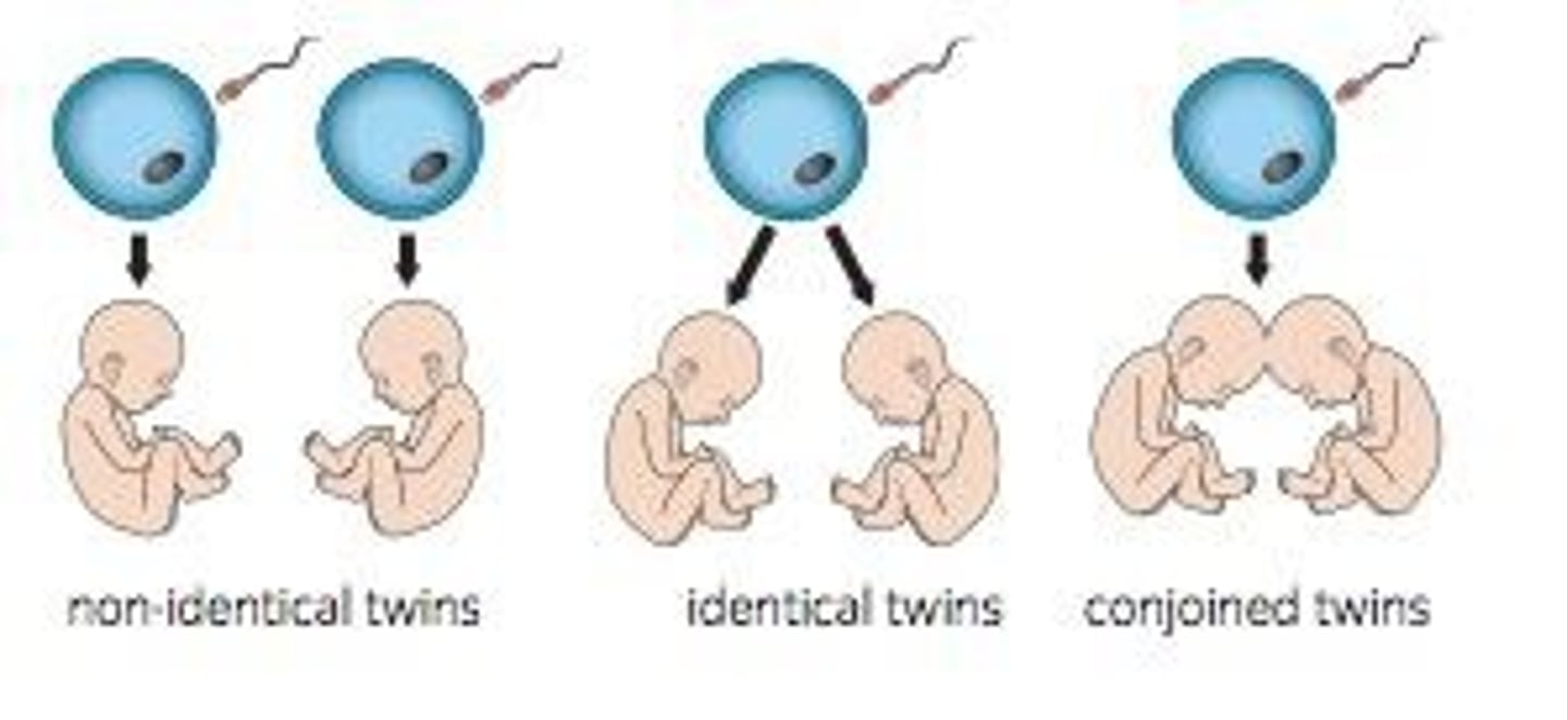 <p>Monozygotic twins who are born physically joined to one another.</p><p>- identical twins that failed to completely separate</p>