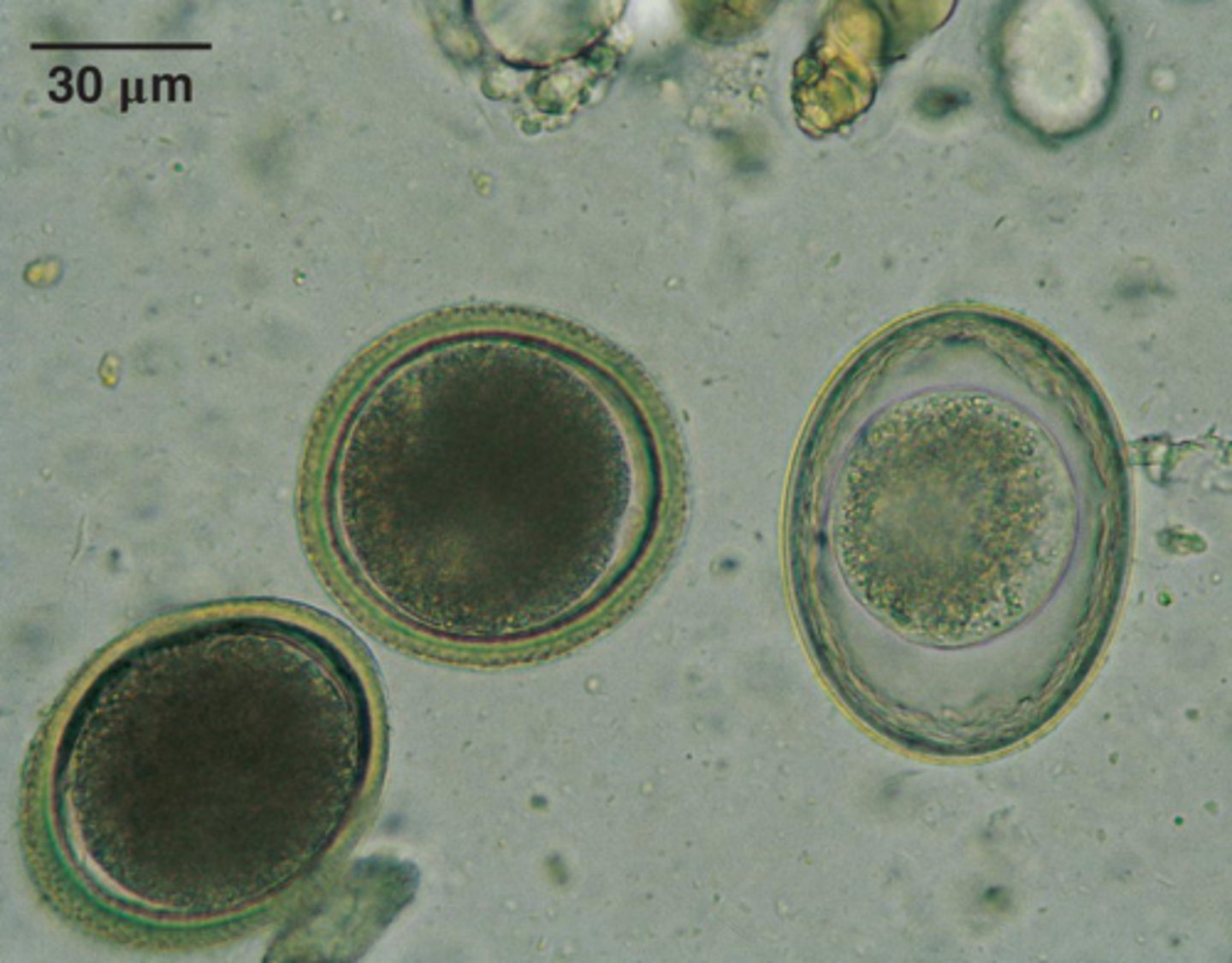 <p>What is the far right parasite if it is from a dog</p>