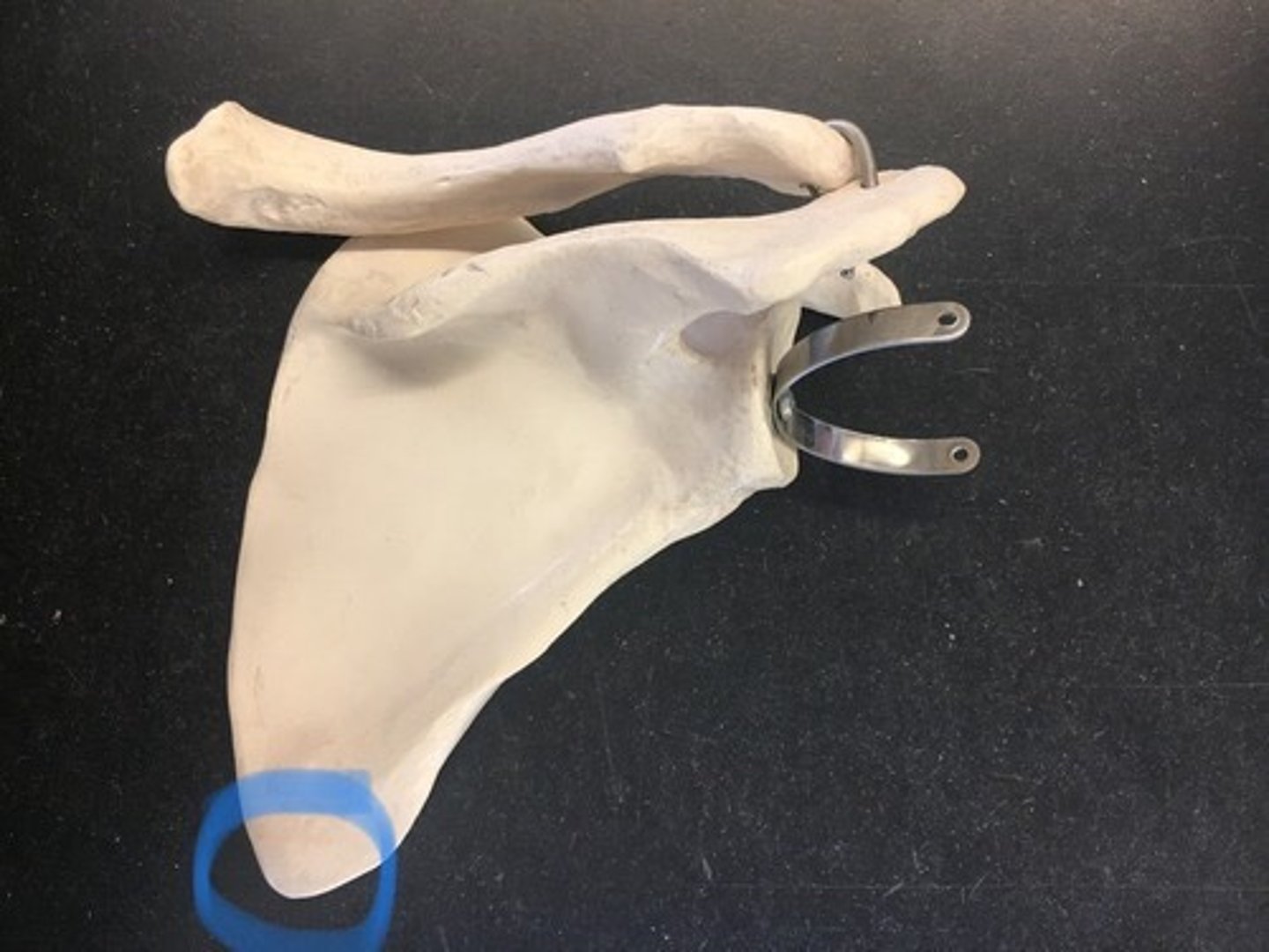 <p>bottom point on body of scapula; point where the medial and lateral borders meet</p>