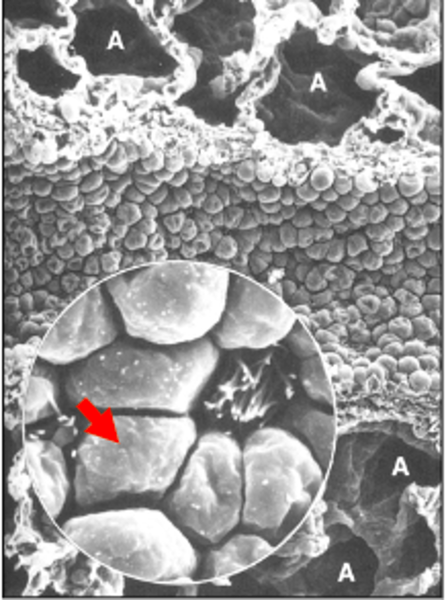 <p>ID the cell:</p><p>-non-ciliated</p><p>-involved in repair processes (stem cells)</p><p>-inhibit inflammation/fibrosis</p><p>-secretory product elevation in plasma may</p><p>be indicative of epithelial injury</p>