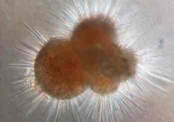 <p>Prolungamenti citoplasmatici sottili e ramificati</p>