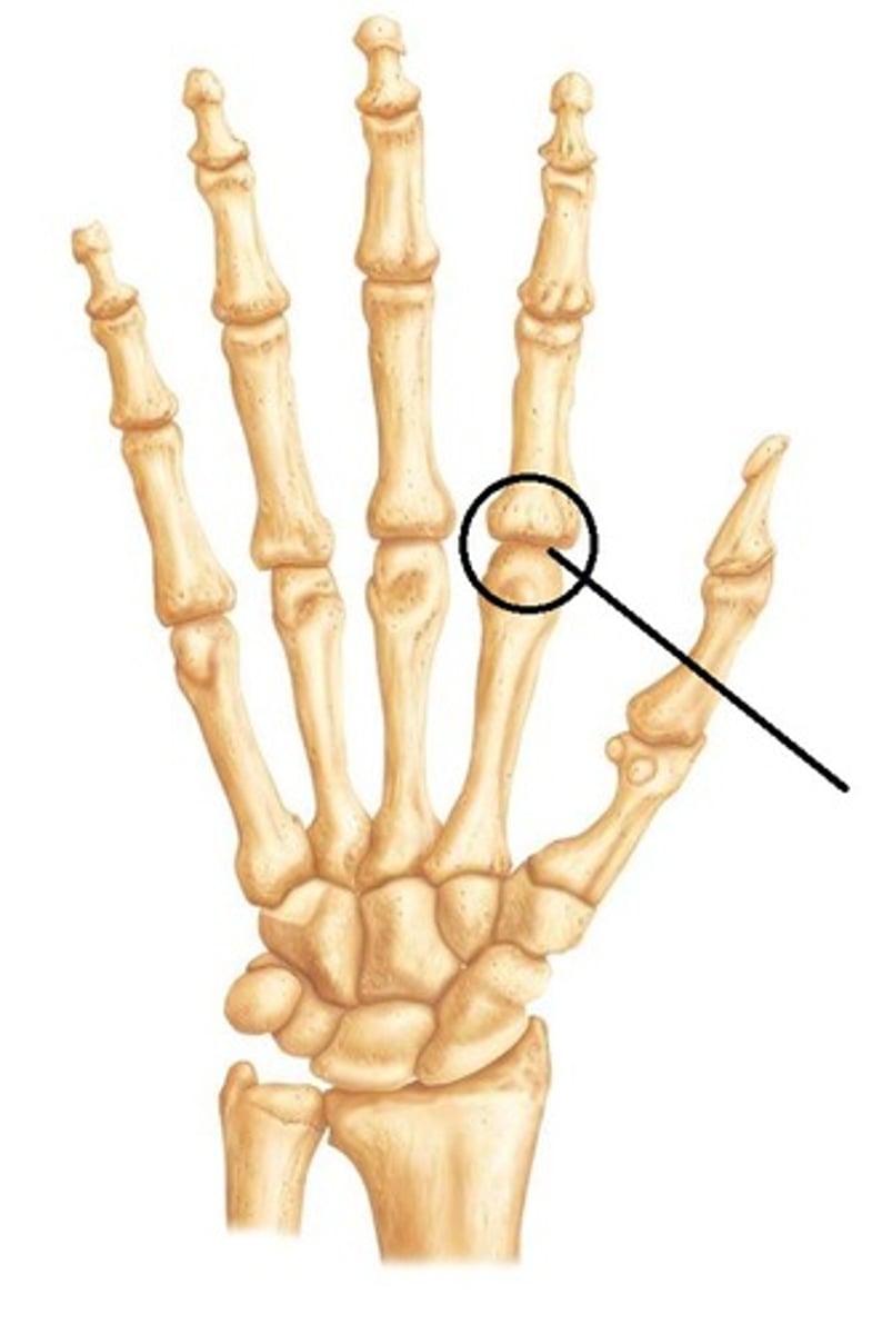 <p>name this joint. And what type of joint is it?</p>