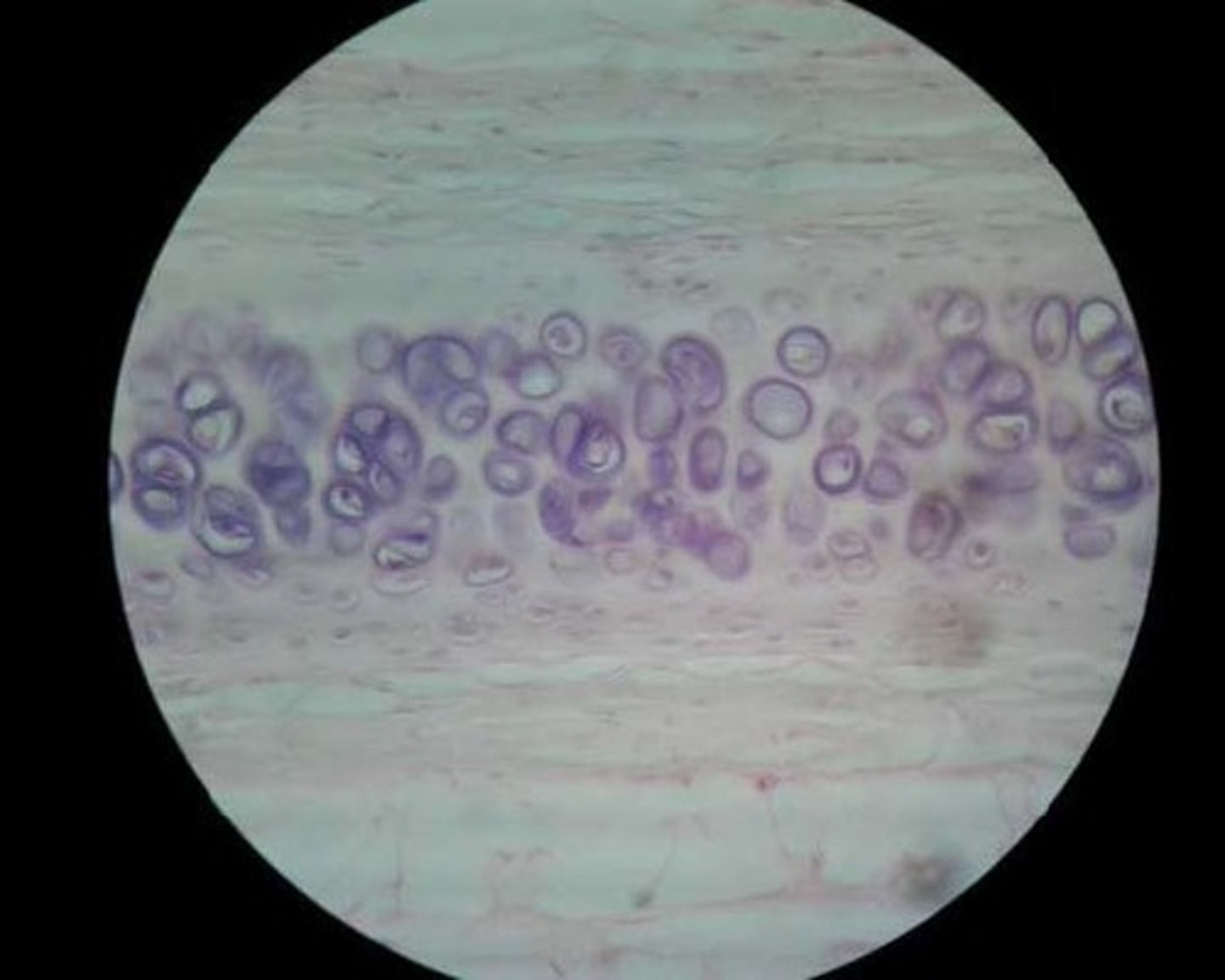 <p>Location: Most common type of cartilage; it is found on the ends of long bones, ribs, and nose</p><p>Function: development and growth of bones.</p>