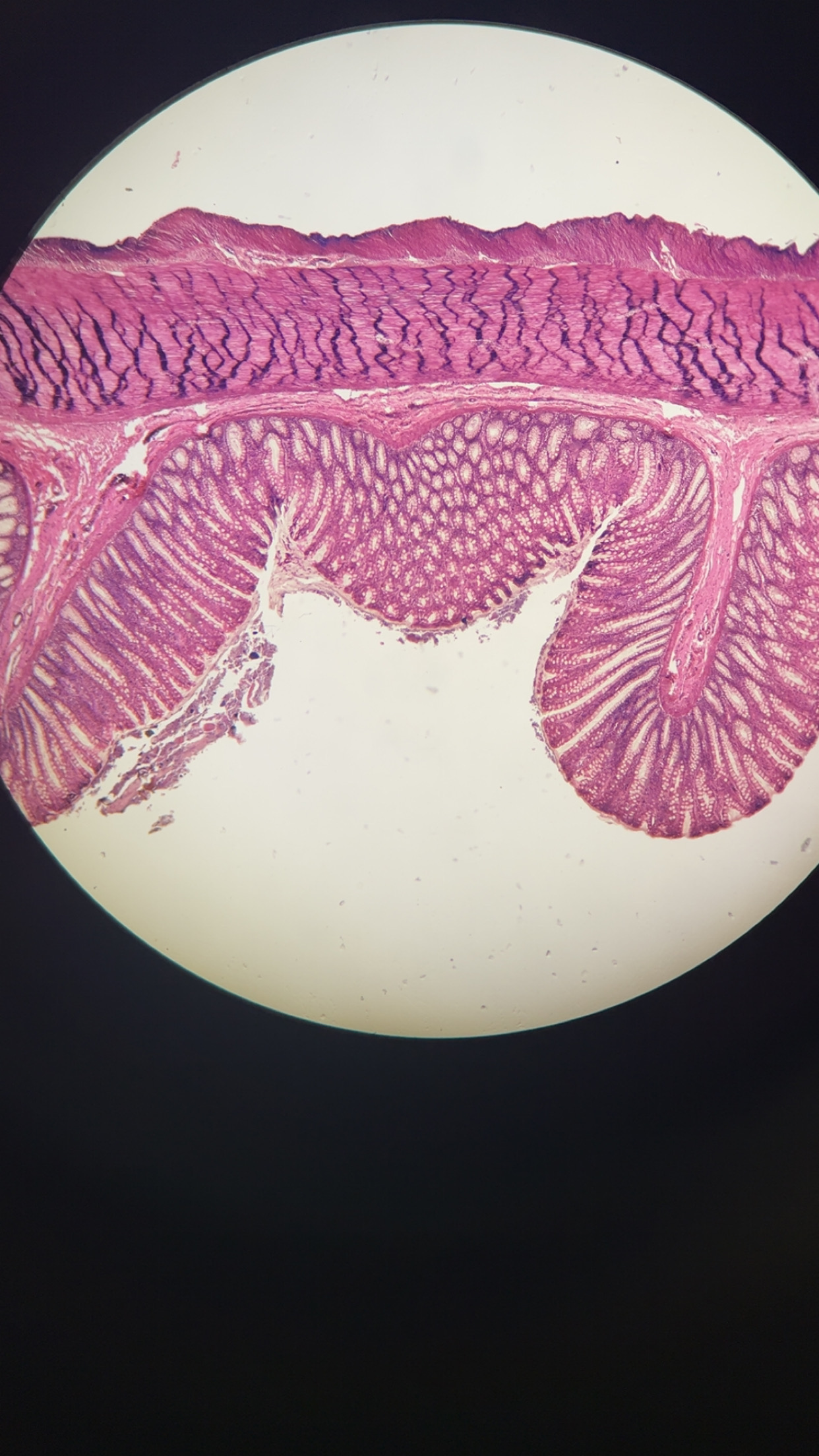 <p>the final section of the digestive system, responsible for absorbing water and electrolytes from indigestible food matter, forming feces, and expelling waste from the body; about 5 feet long</p>