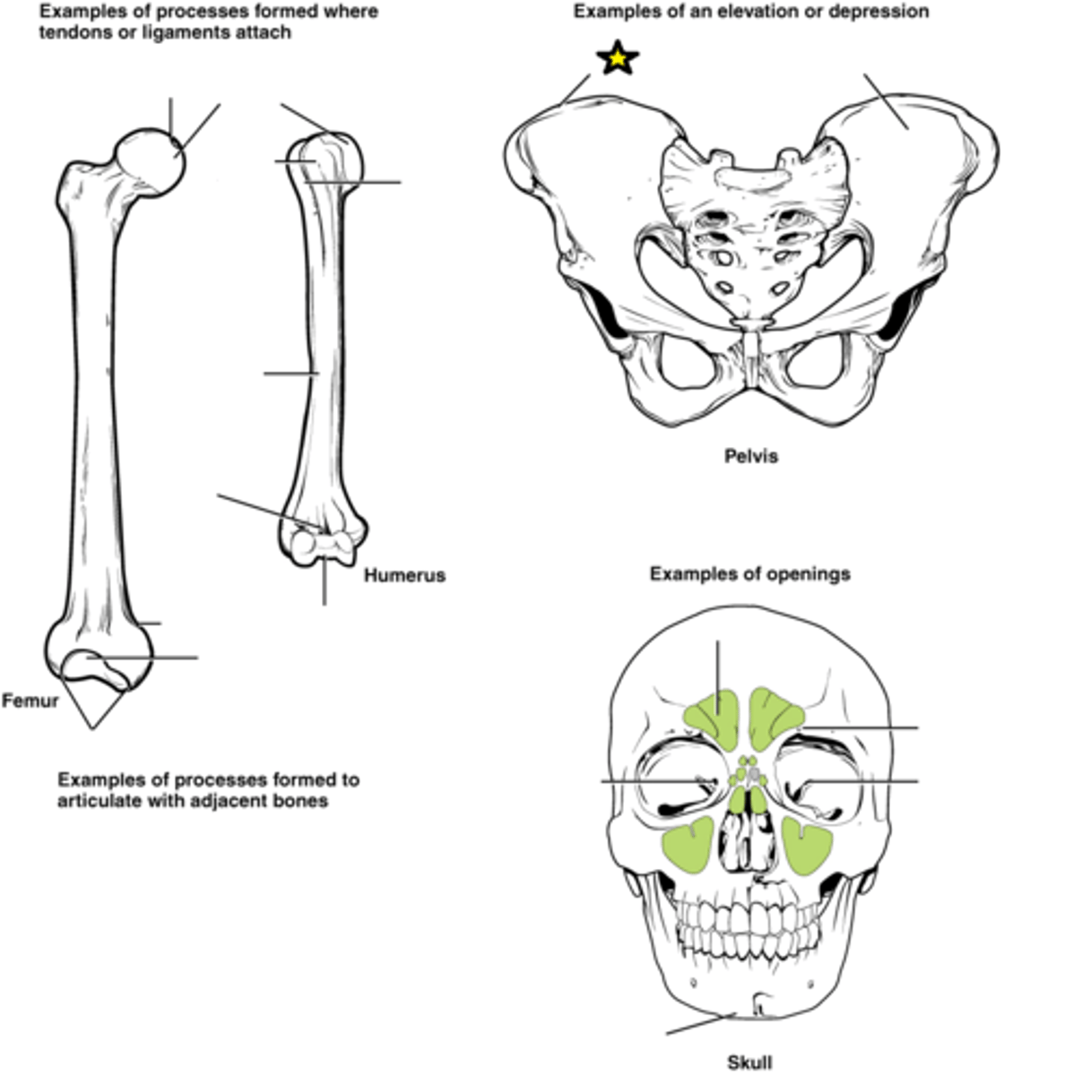 <p>Narrow ridge of bone; usually prominent</p>