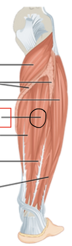 <p>identify + state origin, insertion, action, innervation of marked structure</p>