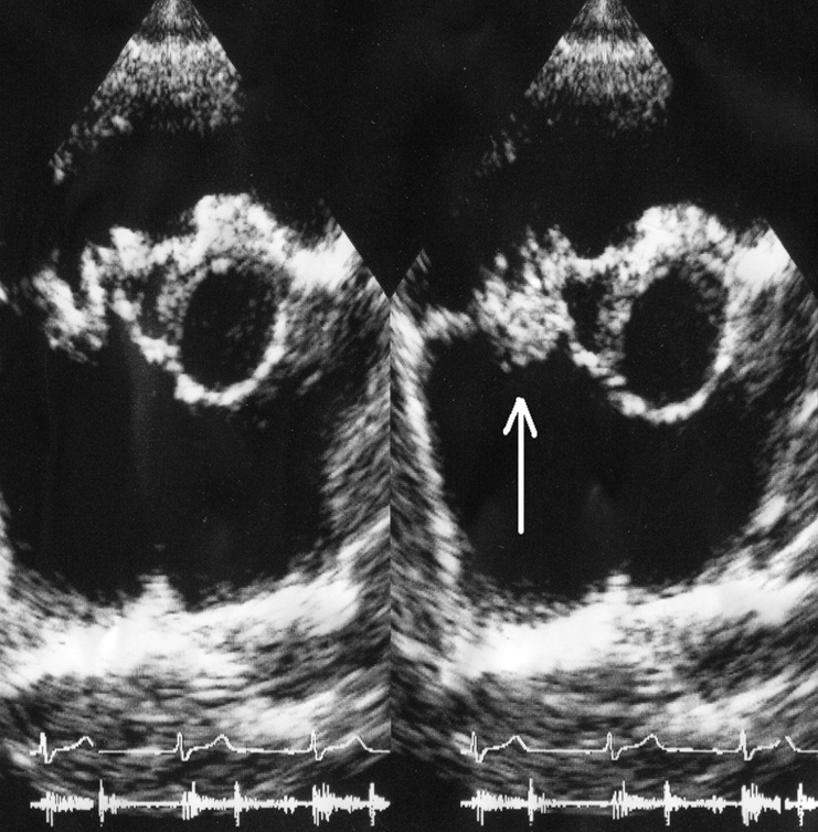 <p>what is seen here?</p>