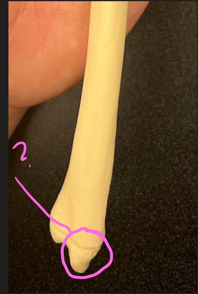 <p>What is this circled region (pointer part)?</p>
