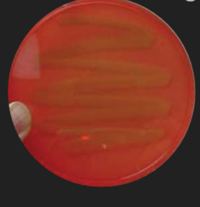 <p>Blood Agar: Staphylococcus Identification — For which staphylococcal capability does this inoculation test?</p>