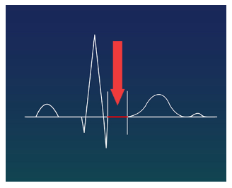 <p><span><span>Which complex, interval, or segment is the arrow pointing to?</span></span></p>