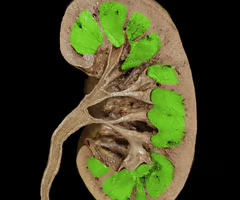 <p>renal medulla </p>