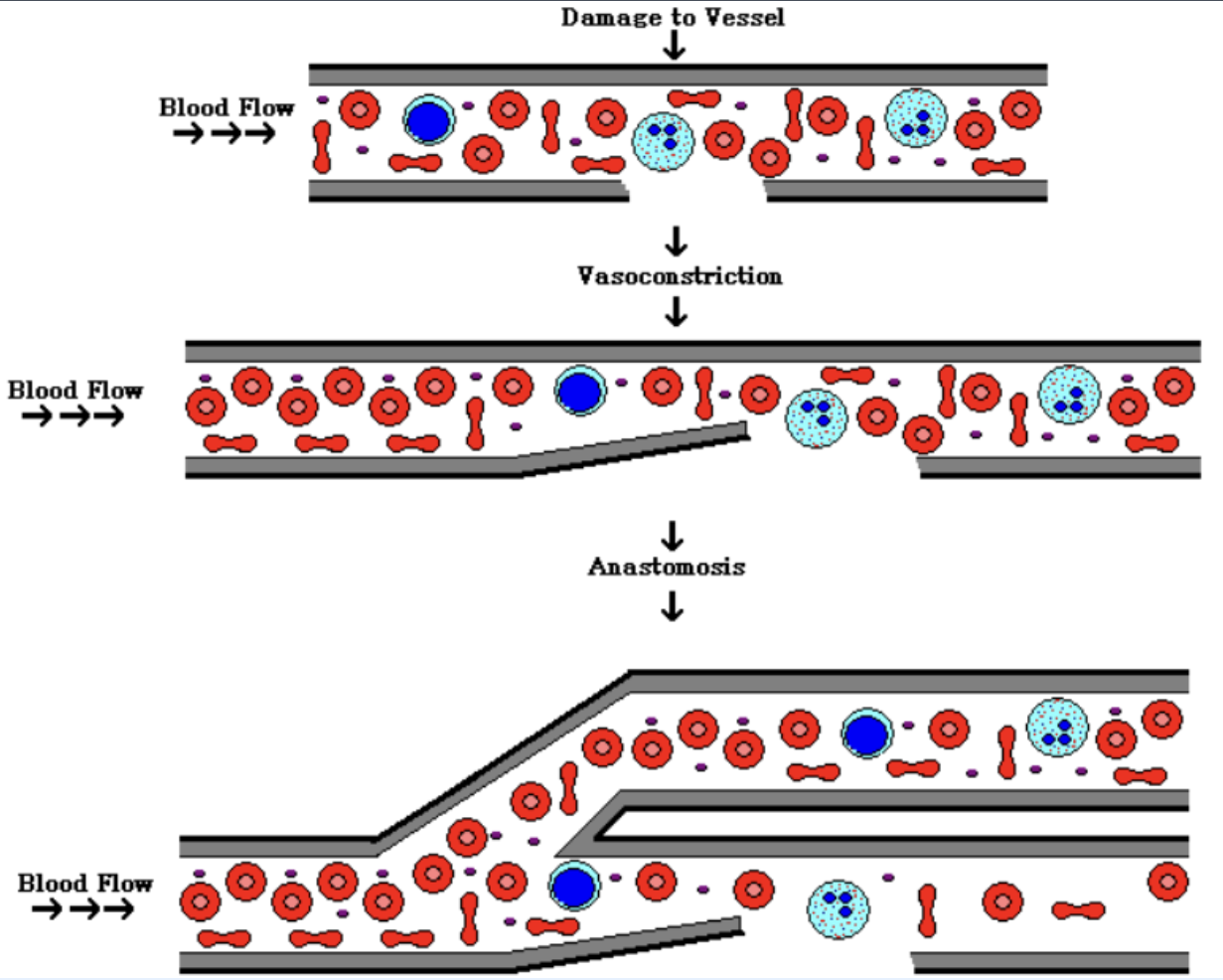 <p>vasoconstriction. diversion of blood flow around damaged vessel</p>