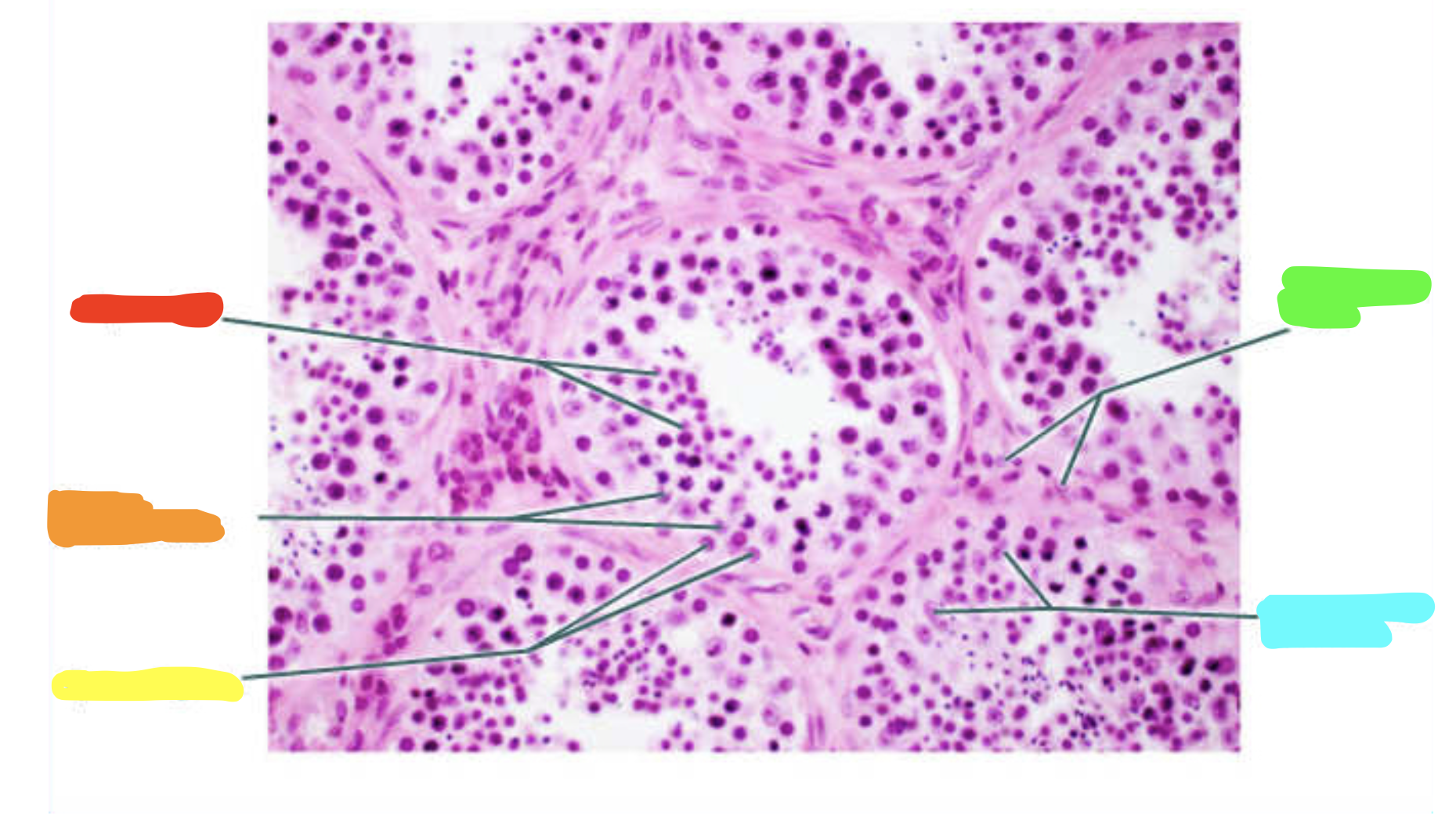 <p>What is this a slide of?</p>