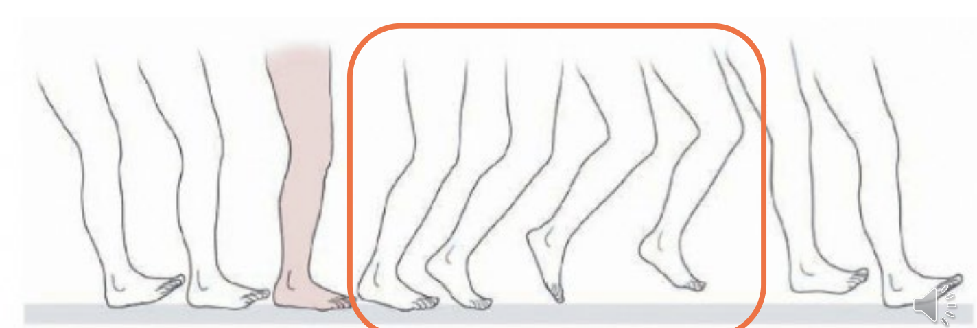 <p>Functional Shortening </p>